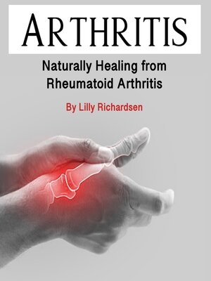 cover image of Arthritis